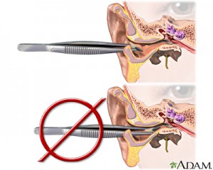 It is important to clean your ears the right way to avoid damage.