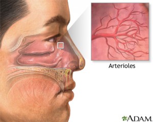 Nosebleeds are a common condition that many people need to treat proactively.